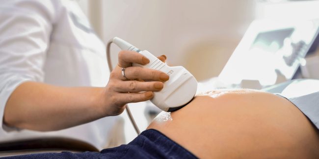 Síndrome de Edward - Yunis Turbay